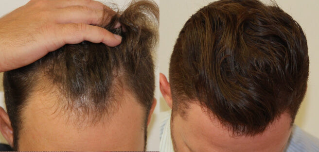 Monat 3